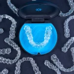 Aparat nakładkowy Invisalign z Warszawy