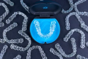 Aparat nakładkowy Invisalign z Warszawy