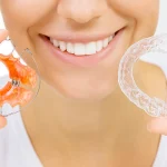 Aparat Invisalign Lublin