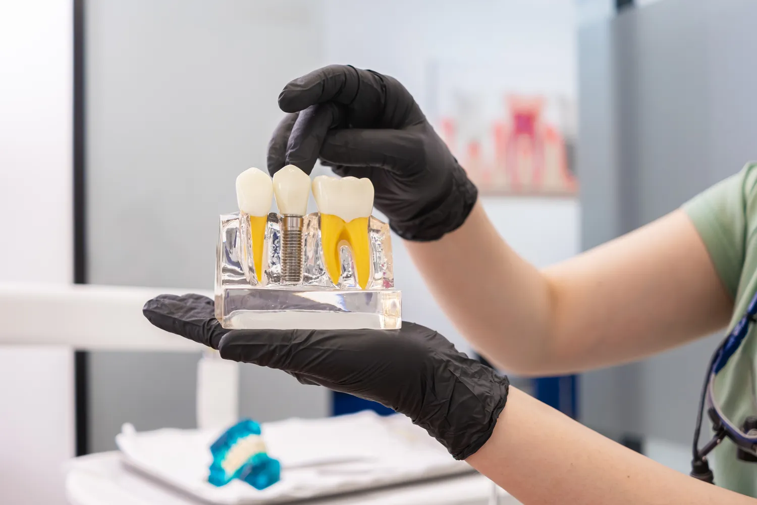 Cena implantu zęba Szczecin