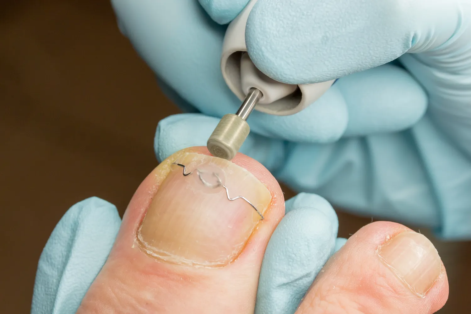 Jaki autoklaw do gabinetu podologicznego?