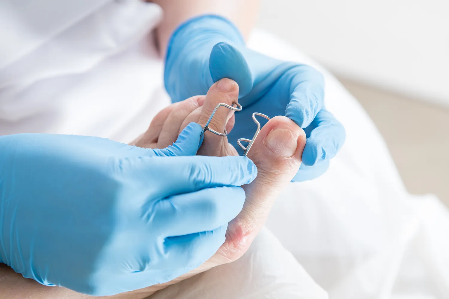 Podolog czym się zajmuje - w jakich schorzeniach pomaga?