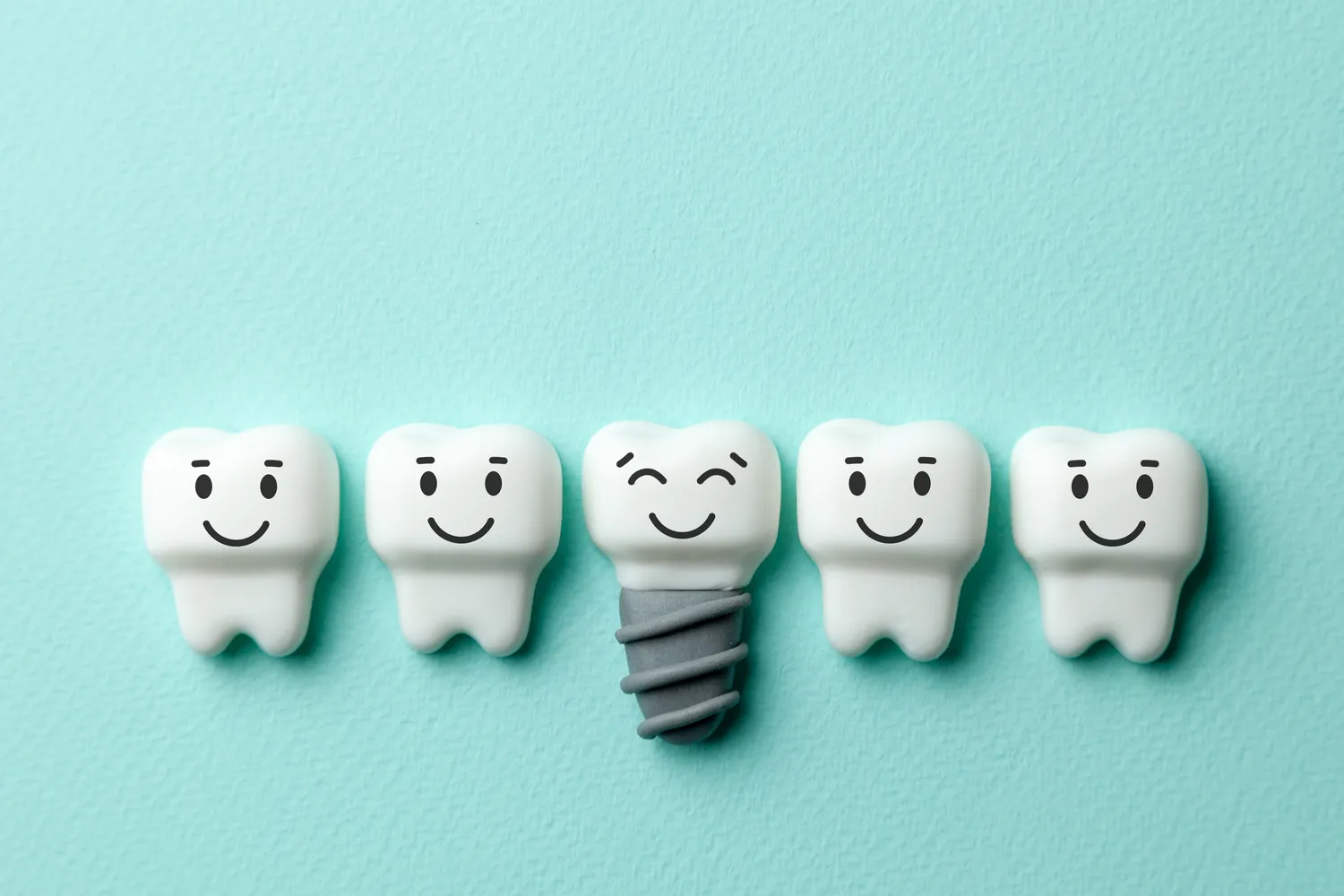 Implanty zębowe cennik Lublin