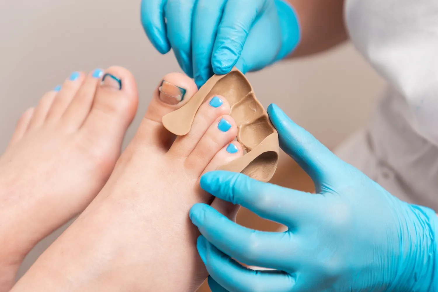 Pedicure podologiczne Warszawa