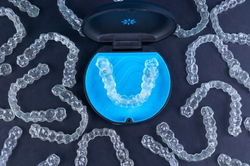 Co to jest Invisalign?